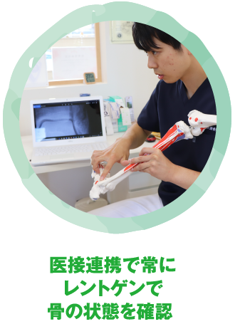 医療連携で常にレントゲンで骨の状態を確認